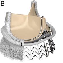 Edwards Lifesciences Heart Valve Products - Osu Mri Implants