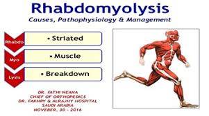 How To Pronounce Rhabdomyolysis - Youtube