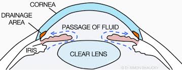 Narrow-Angle Glaucoma: Causes, Symptoms And Treatment